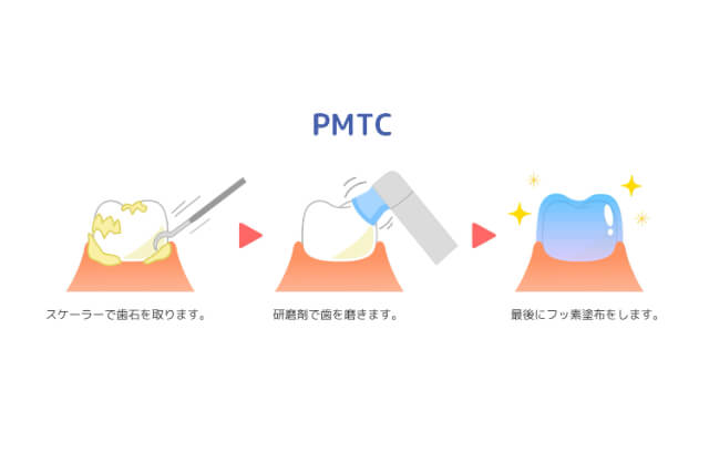 PMTC